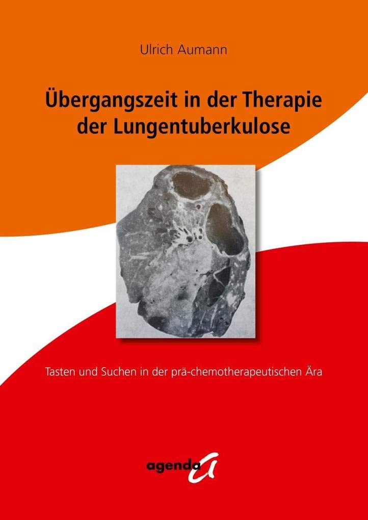Übergangszeit in der Therapie der Lungentuberkulose: Tasten und Suchen in der prä-chemotherapeutischen Ära Medicine