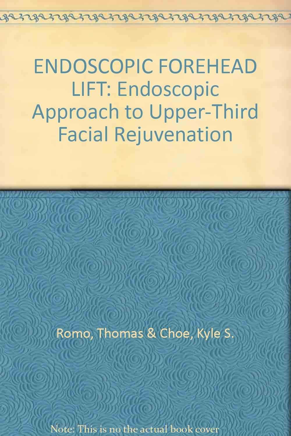 Endoscopic Forehead Lift: Endoscopic Approach to Upper-Third Facial Rejuvenation (Ärzte-Anleitungen /Fachgebiet Plastische Chirurgie) Medicine