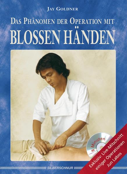 Das Phänomen der Operation mit blossen Händen Health, Nutrition & Fitness Books