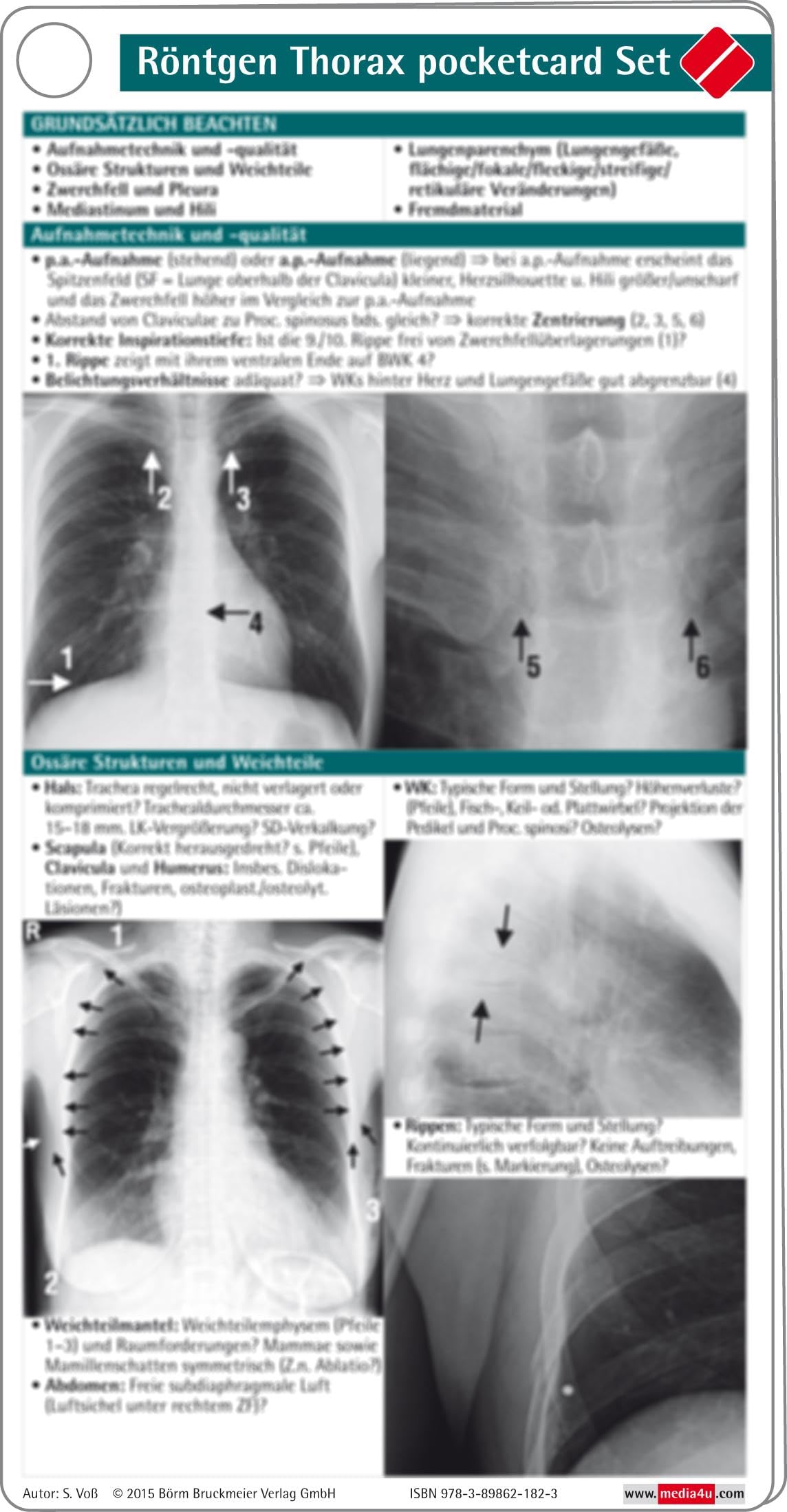 Röntgen Thorax pocketcard Set Medicine