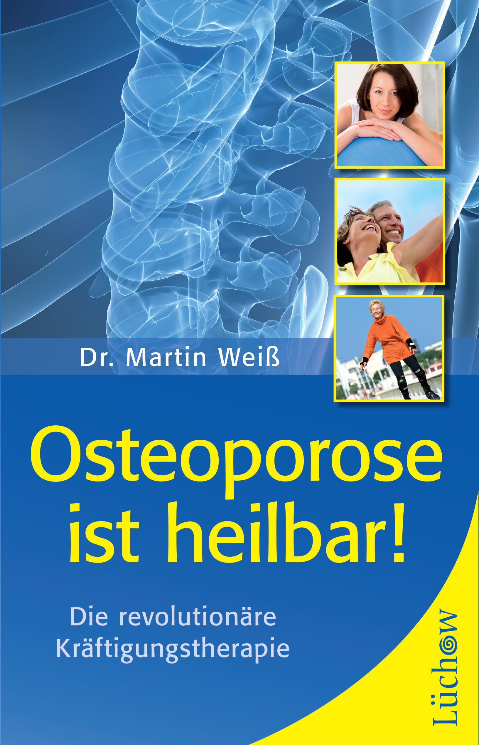 Osteoporose ist heilbar! Health, Nutrition & Fitness