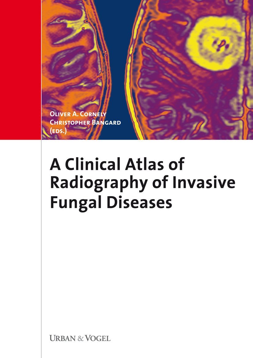 A Clinical Atlas of Radiography of Invasive Fungal Diseases Medicine