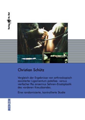 Vergleich der Ergebnisse von arthroskopisch assistierter Ligamentum patellae- versus vierfacher Pes anserinus Sehnen- Ersatzplastik des vorderen Kreuzbandes. Eine randomisierte, kontrollierte Studie Medicine