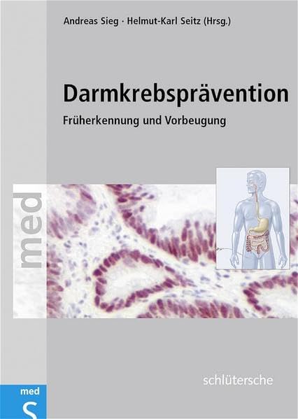 Darmkrebsprävention: Früherkennung und Vorbeugung Medicine