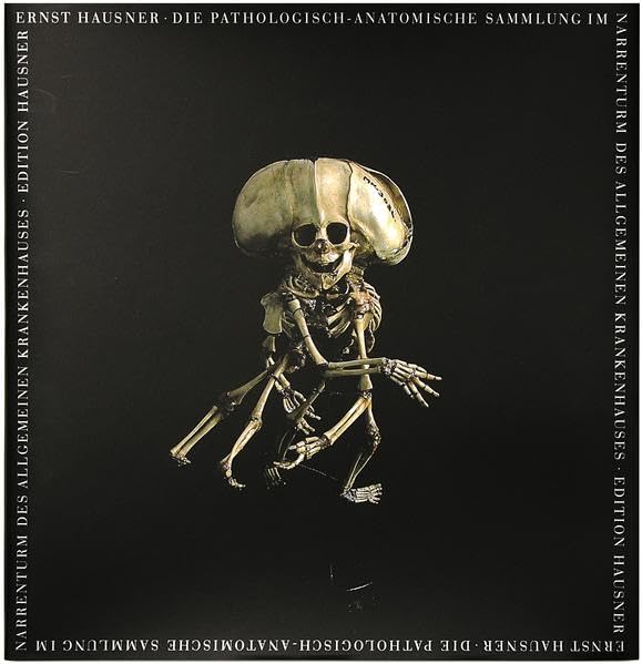 Die Pathologisch-Anatomische Sammlung im Narrenturm des Alten Allgemeinen Krankenhauses Medicine