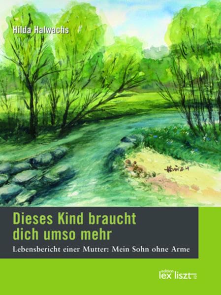 Dieses Kind braucht dich umso mehr: Lebensbericht einer Mutter: Mein Sohn ohne Arme - Halwachs, Hilda book