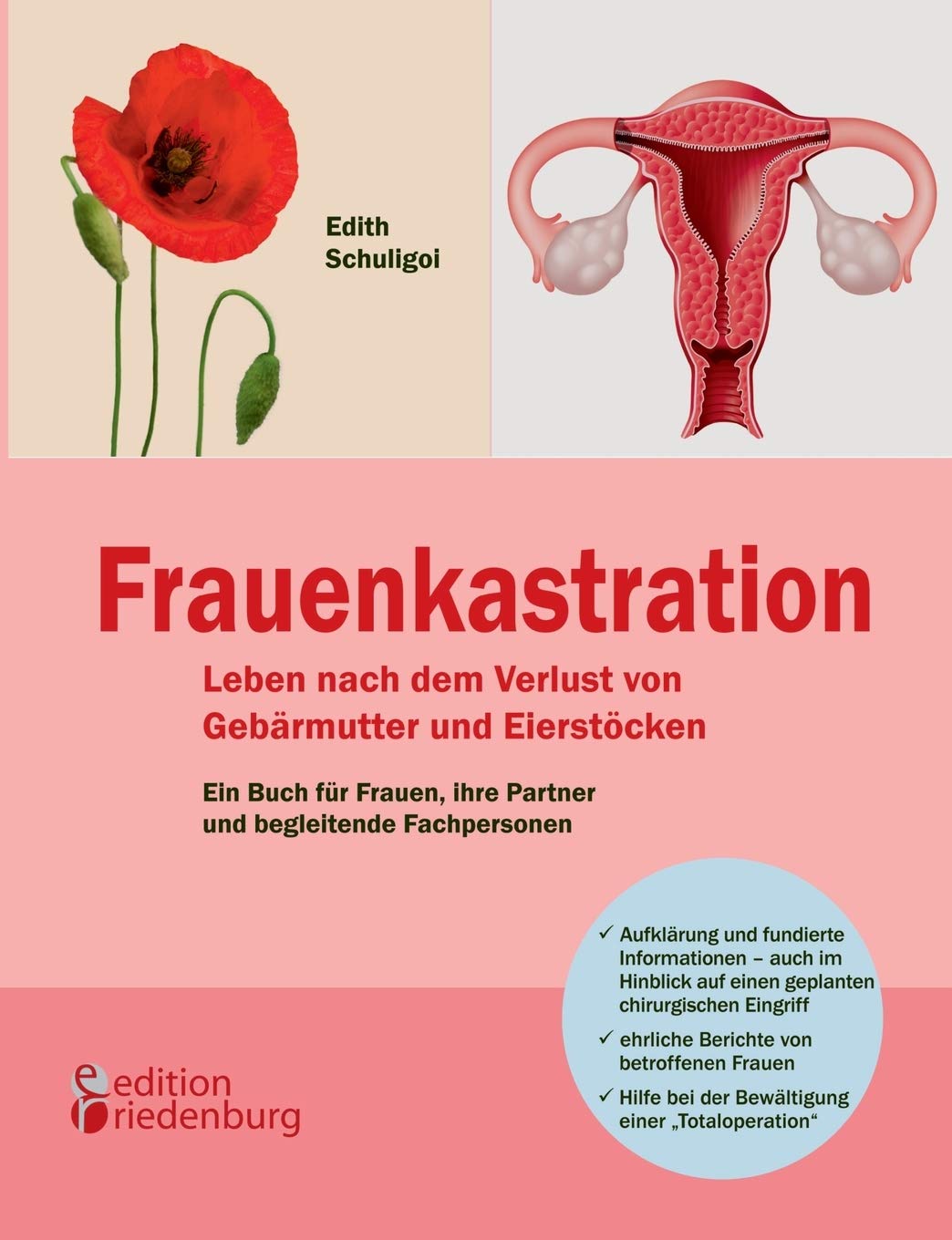 Frauenkastration - Leben nach dem Verlust von Gebärmutter und Eierstöcken: Ein Buch für Frauen, ihre Partner und begleitende Fachpersonen Medicine