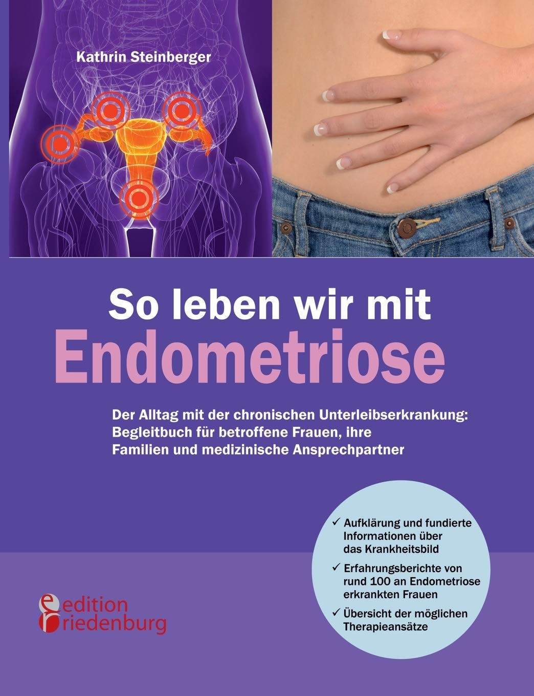 So leben wir mit Endometriose - Der Alltag mit der chronischen Unterleibserkrankung: Begleitbuch für betroffene Frauen, ihre Familien und medizinische Ansprechpartner Medicine