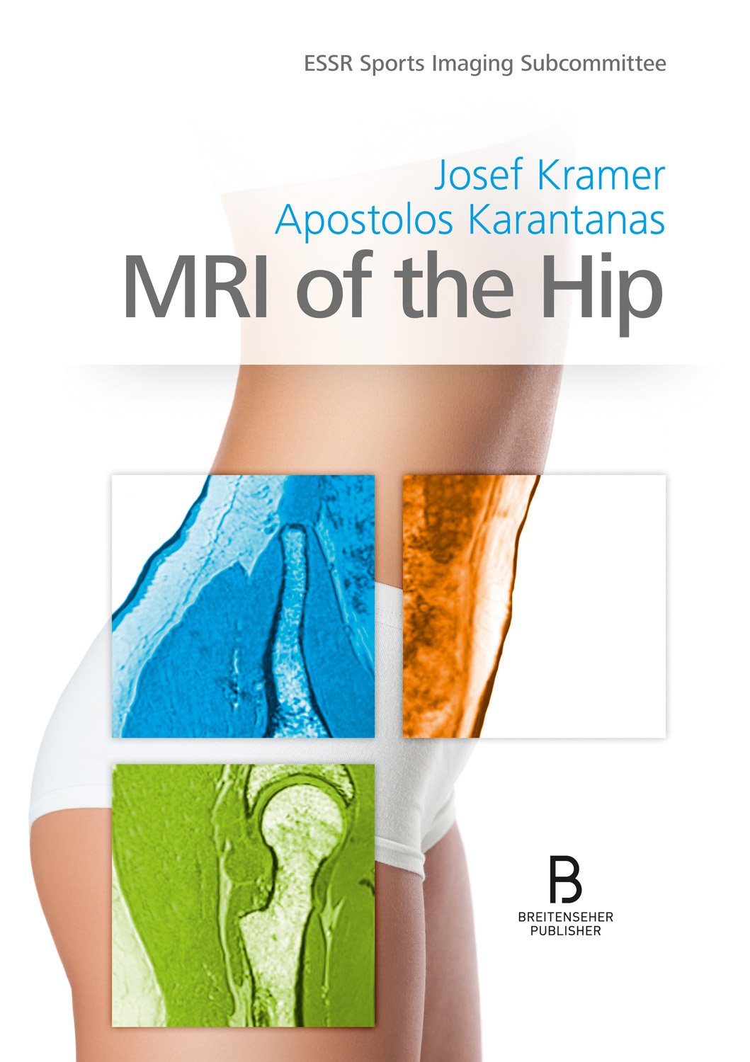 Product Image: MRI of the Hip