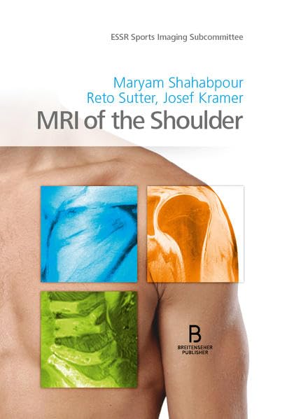 MRI of the Shoulder Medicine