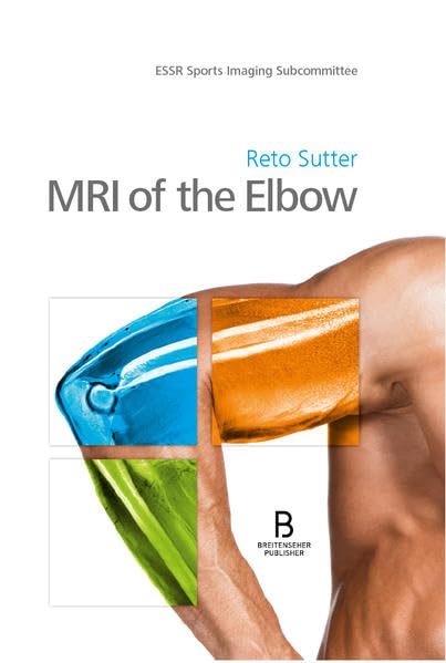 Product Image: MRI of the Elbow