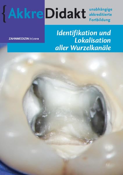 Identifikation und Lokalisation aller Wurzelkanäle (AkkreDidakt Zahnmedizin) Medicine