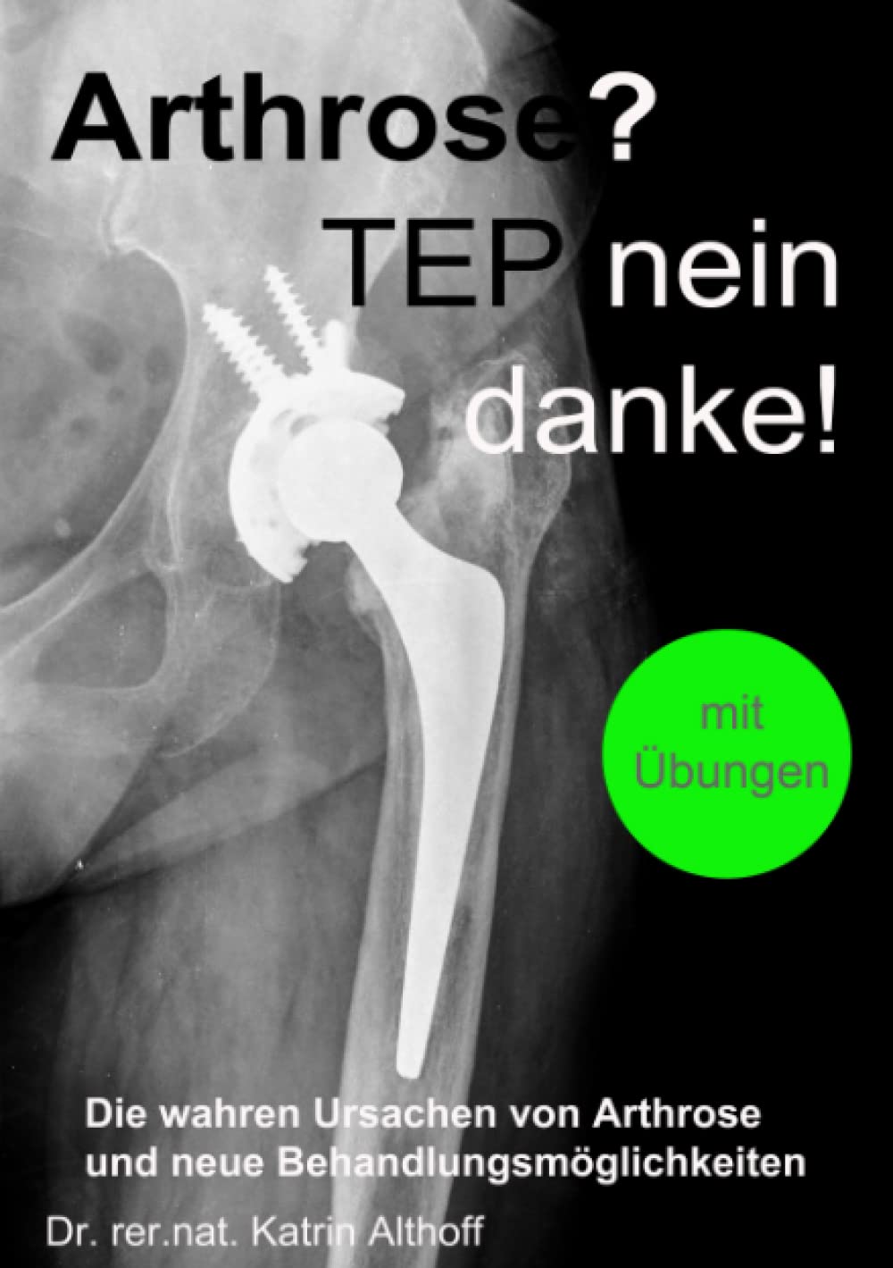 Arthrose? TEP nein danke!: Die wahren Ursachen von Arthrose und neue Behandlungsmöglichkeiten Medicine