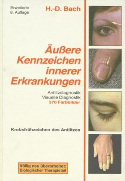 Antlitzdiagnostik: Äußere Kennzeichen innerer Erkrankungen, Bd. 1: Lehrbuch und Farbatlas für Pathophysiognomie und visuelle Diagnostik Medicine