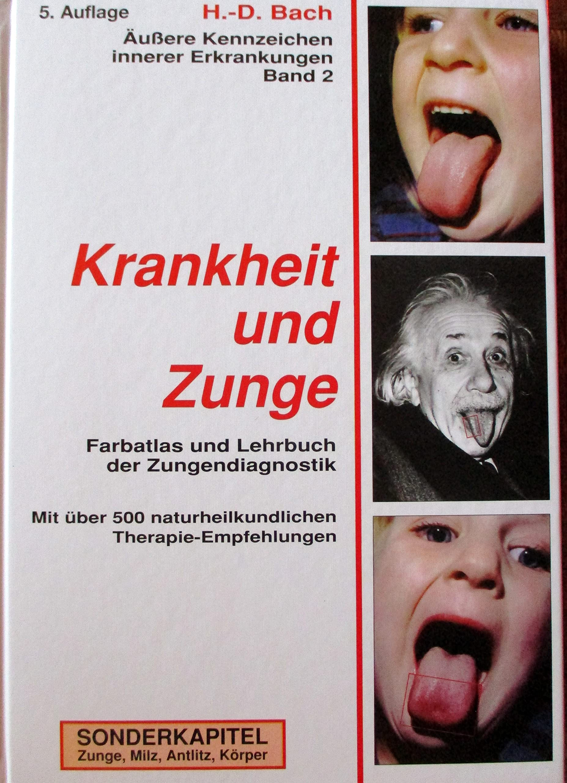 Antlitzdiagnostik: Äußere Kennzeichen innerer Erkrankungen, Bd.2, Krankheit und Zunge: Farbatlas und Lehrbuch der Zungendiagnostik. Sonderkapitel: Zunge, Milz, Antlitz, Körper Medicine