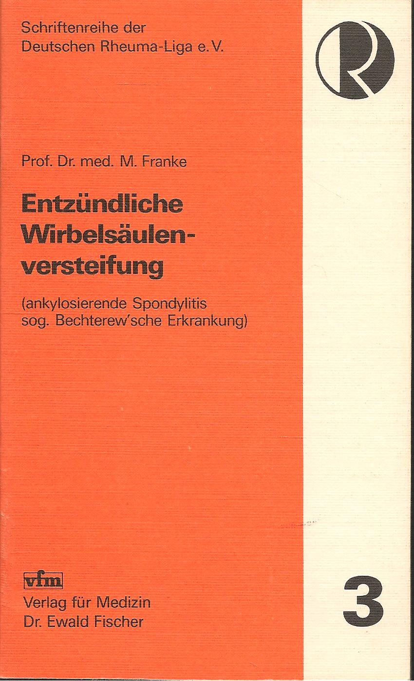 Entzündliche Wirbelsäulenversteifung. Ankylosierende Spondylitis, sog. Bechterew'sche Erkrankung Books