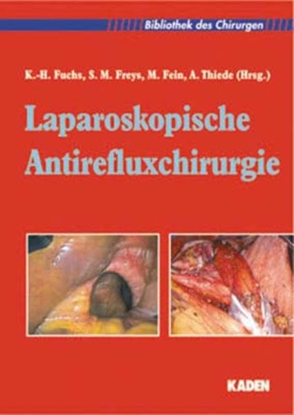 Laparoskopische Antirefluxchirurgie (Bibliothek des Chirurgen) Medicine