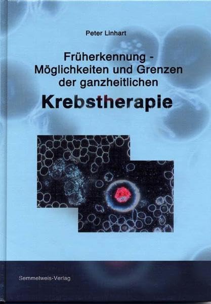 Früherkennung - Möglichkeiten und Grenzen der ganzheitlichen Krebstherapie Medicine