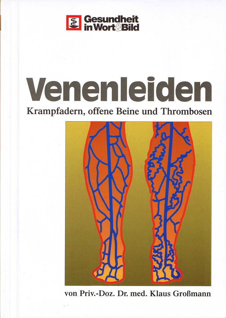 Venenleiden: Krampfadern, offene Beine, Thrombosen Medicine