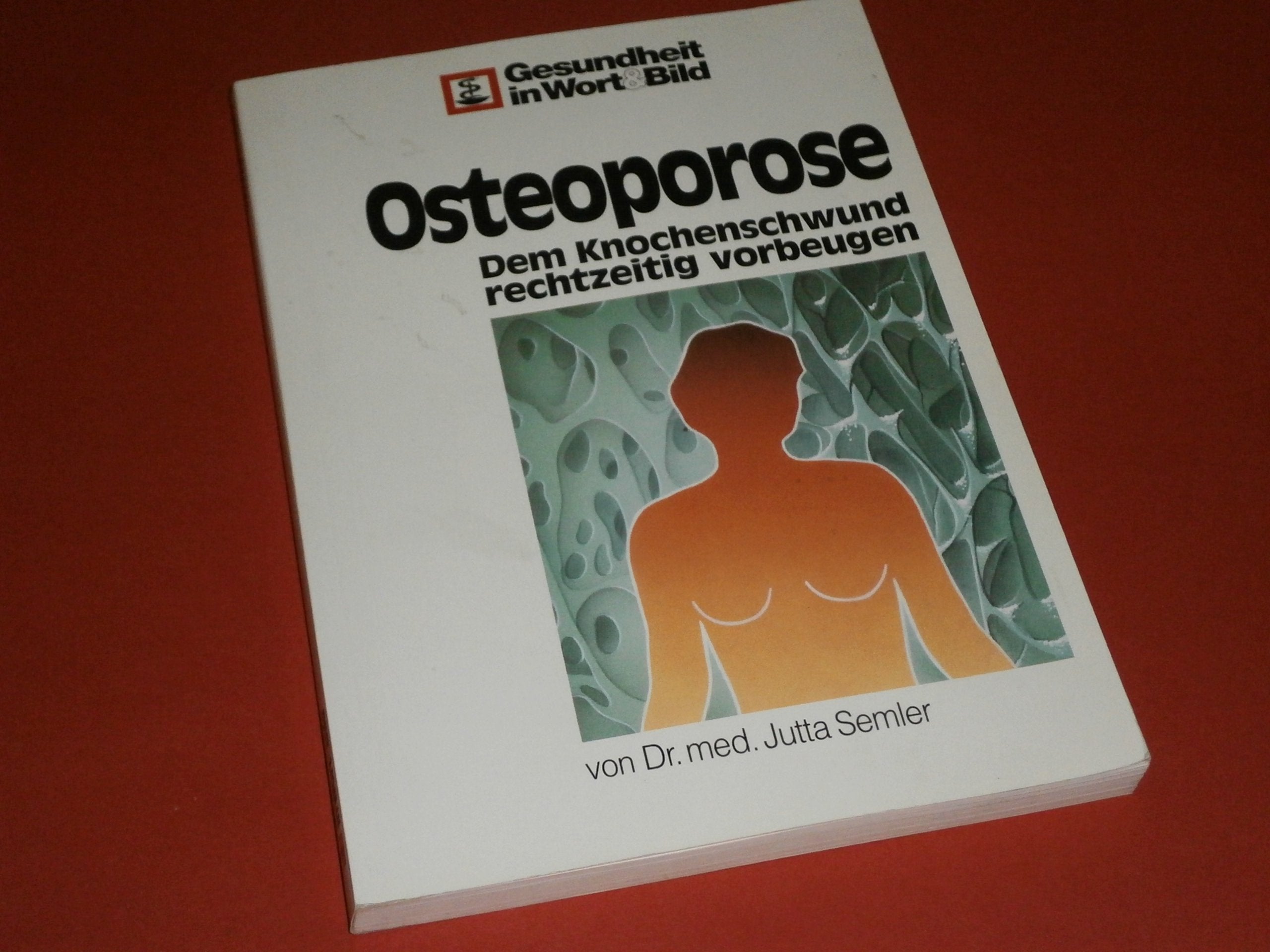 Osteoporose: Dem Knochenschwund rechtzeitig vorbeugen Medicine