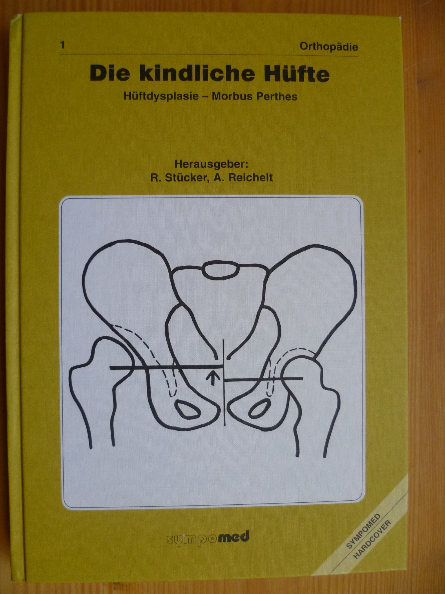 Die kindliche Hüfte: Hüftdysplasie - Morbus Perthes Medicine
