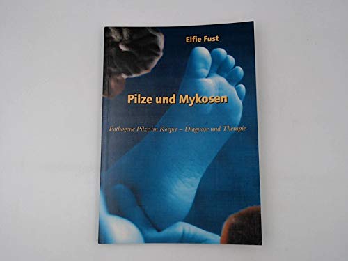 Pilze und Mykosen: Pathogene Pilze im Körper. Diagnose und Therapie Natural Sciences