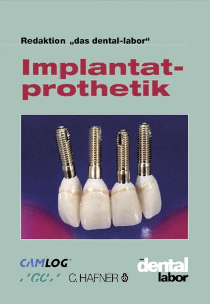 Implantatprothetik: Redaktion "Das Dentallabor" Medicine
