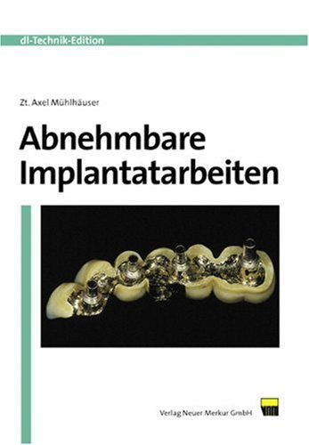 Abnehmbare Implantatarbeiten Medicine