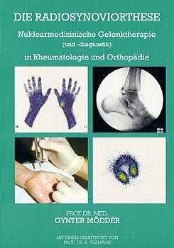 Die Radiosynoviorthese: Nuklearmedizinische Gelenktherapie (und -diagnostik) in Rheumatologie und Orthopädie (Livre en allemand) book