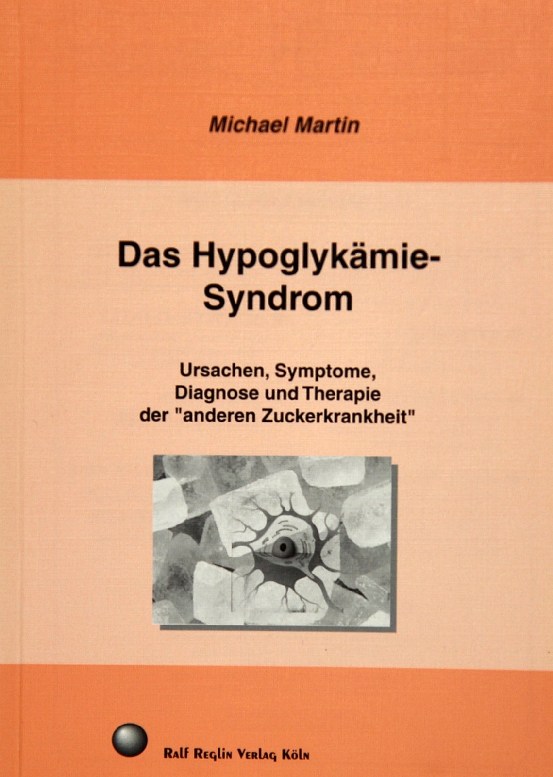 Das Hypoglykämie-Syndrom. Ursachen, Symptome, Diagnostik und Therapie der "anderen Zuckerkrankheit" Health, Nutrition & Fitness