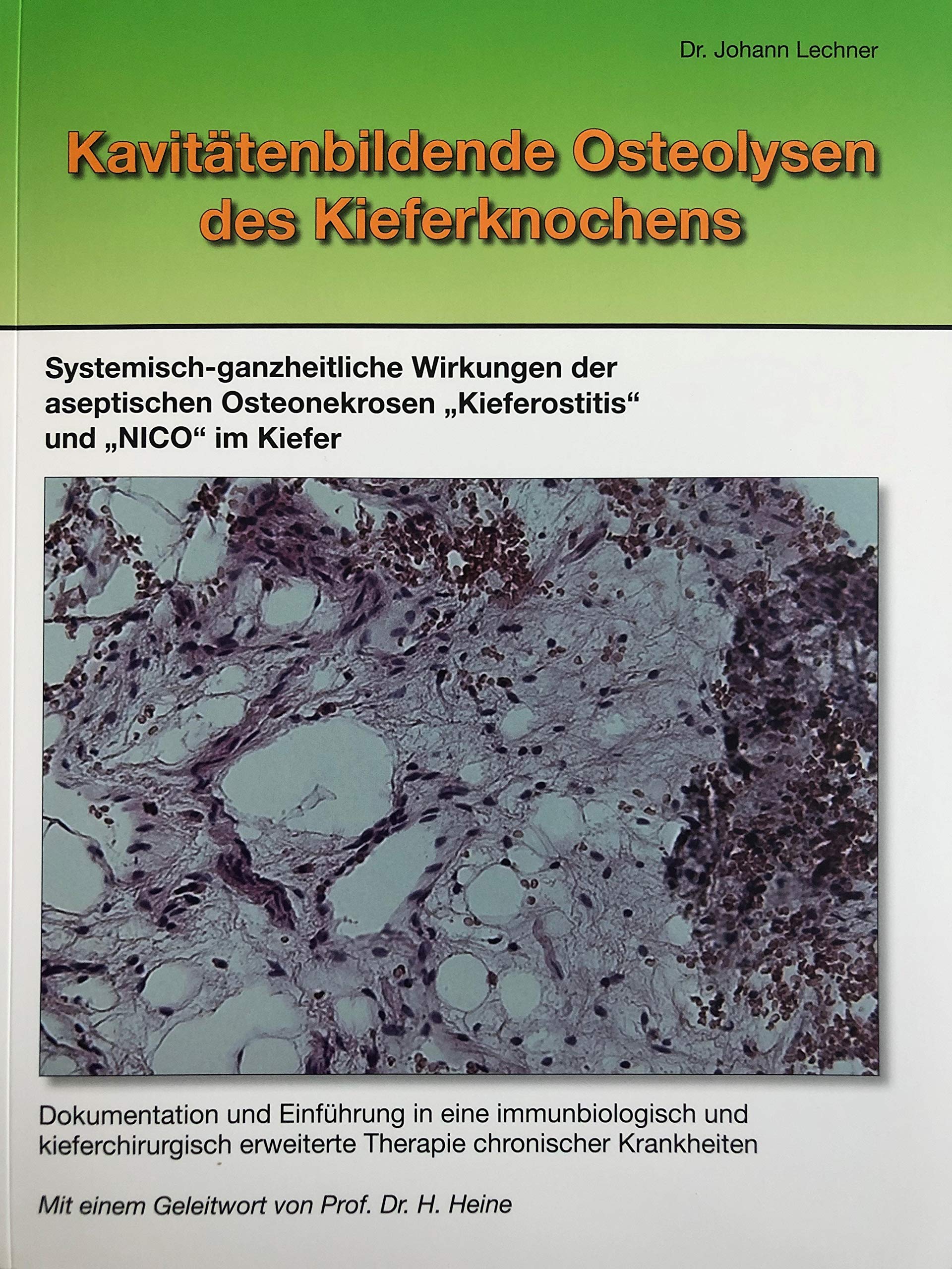 Lechner, J: Kavitätenbildende Osteolysen des Kiefernknochens book