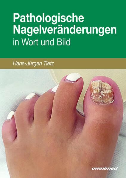 Pathologische Nagelveränderungen in Wort und Bild Medicine