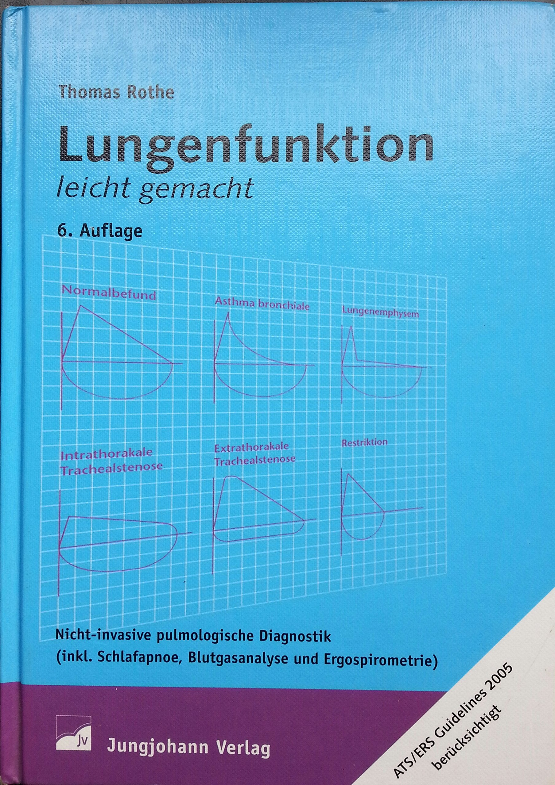 Lungenfunktion leicht gemacht: Nicht-invasive pulmologische Diagnostik (inkl. Schlafapnoe, Blutgasanalyse und Ergospirometrie) Medicine