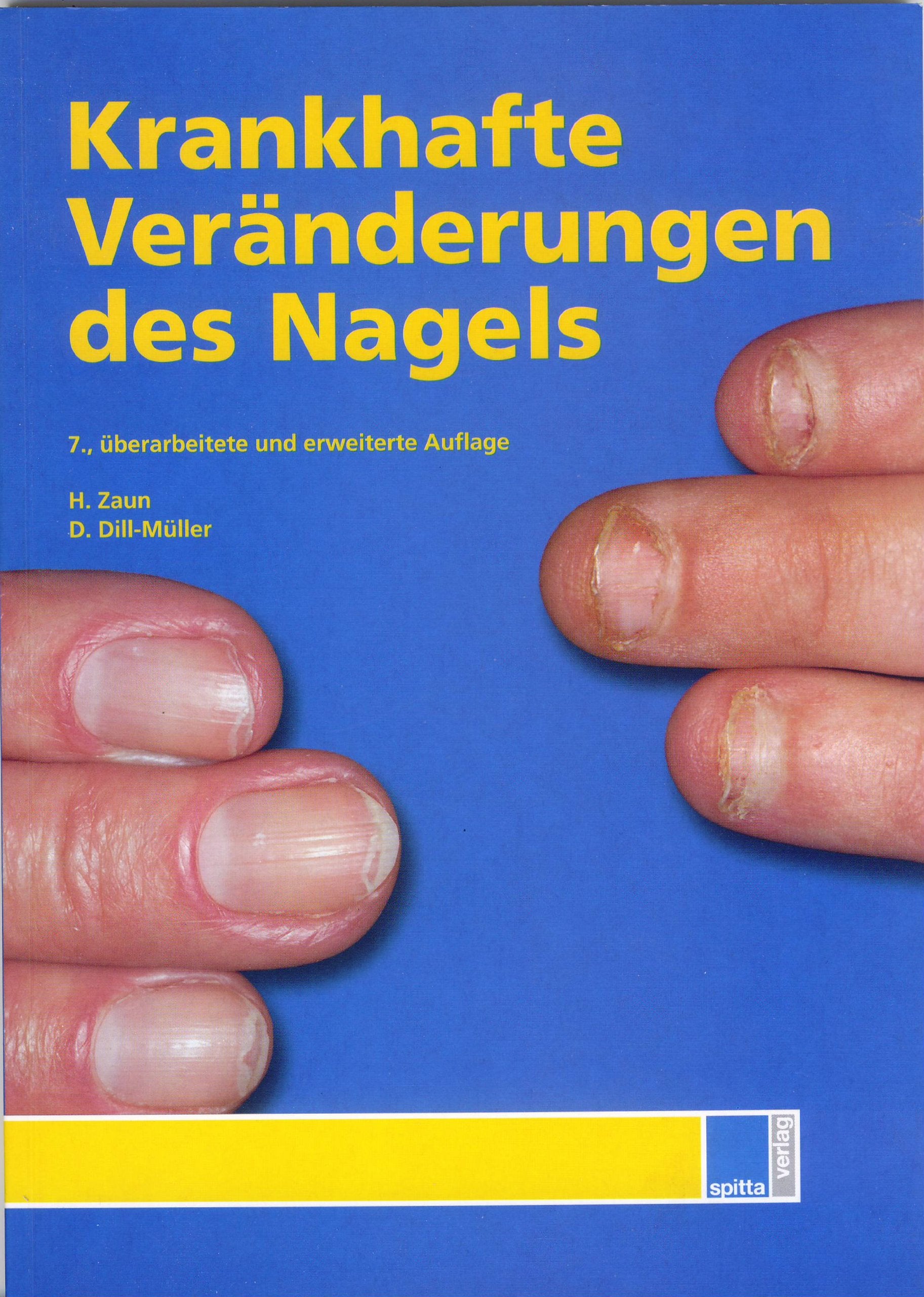 Krankhafte Veränderungen des Nagels Medicine