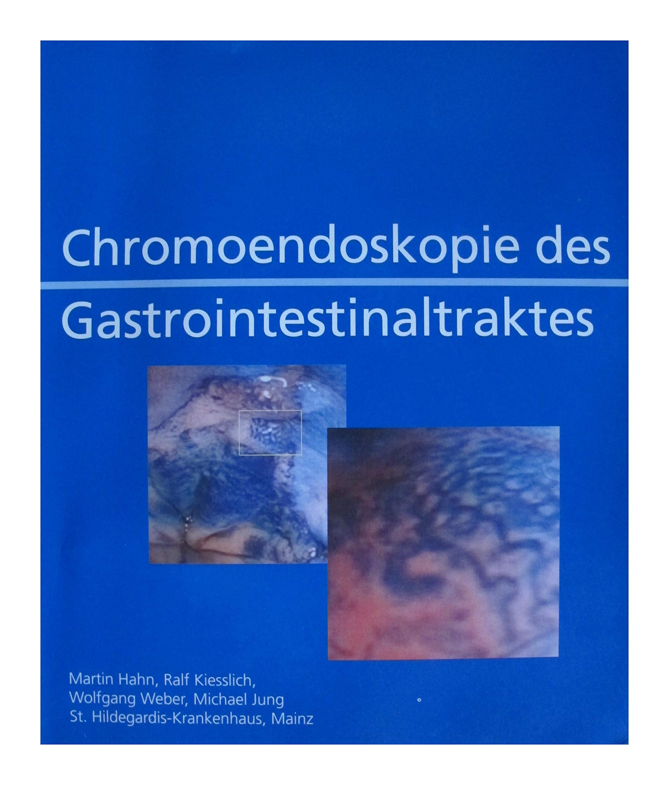 Chromoendoskopie des Gastrointestinaltraktes Medicine
