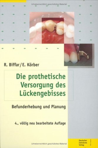 Die prothetische Versorgung des Lückengebisses. Befunderhebung und Planung Medicine