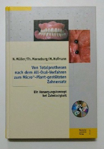 Von Totalprothesen nach dem All-Oral-Verfahren zum Micro©-Plant-gestützten Zahnersatz: Fachbuch mit einliegender CD-ROM Medicine
