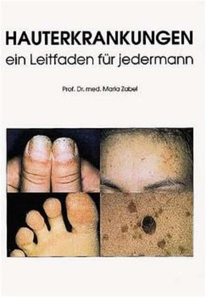 Hauterkrankungen - ein Leitfaden für jedermann Medicine