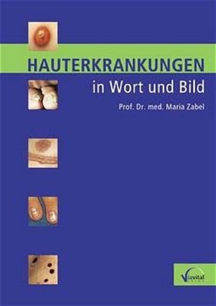Hauterkrankungen in Wort und Bild book