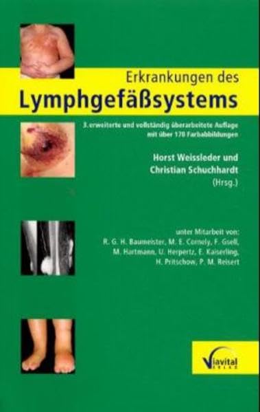 Erkrankungen des Lymphgefässsystems Medicine