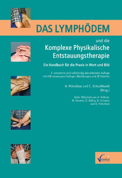 Das Lymphödem und die Komplexe physikalische Entstauungstherapie: Ein Handbuch für die Praxis in Wort und Bild Medicine Books