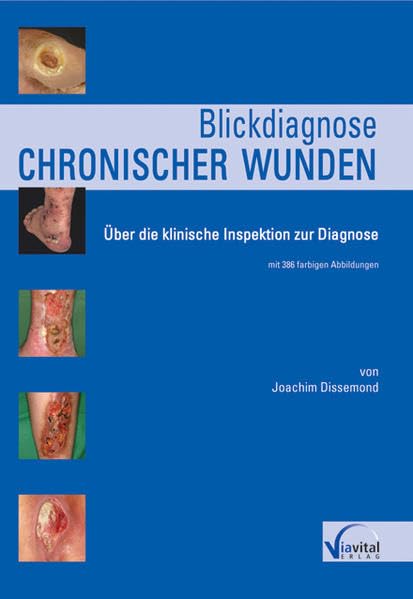 Blickdiagnose chronischer Wunden: Über die klinische Inspektion zur Diagnose Medicine