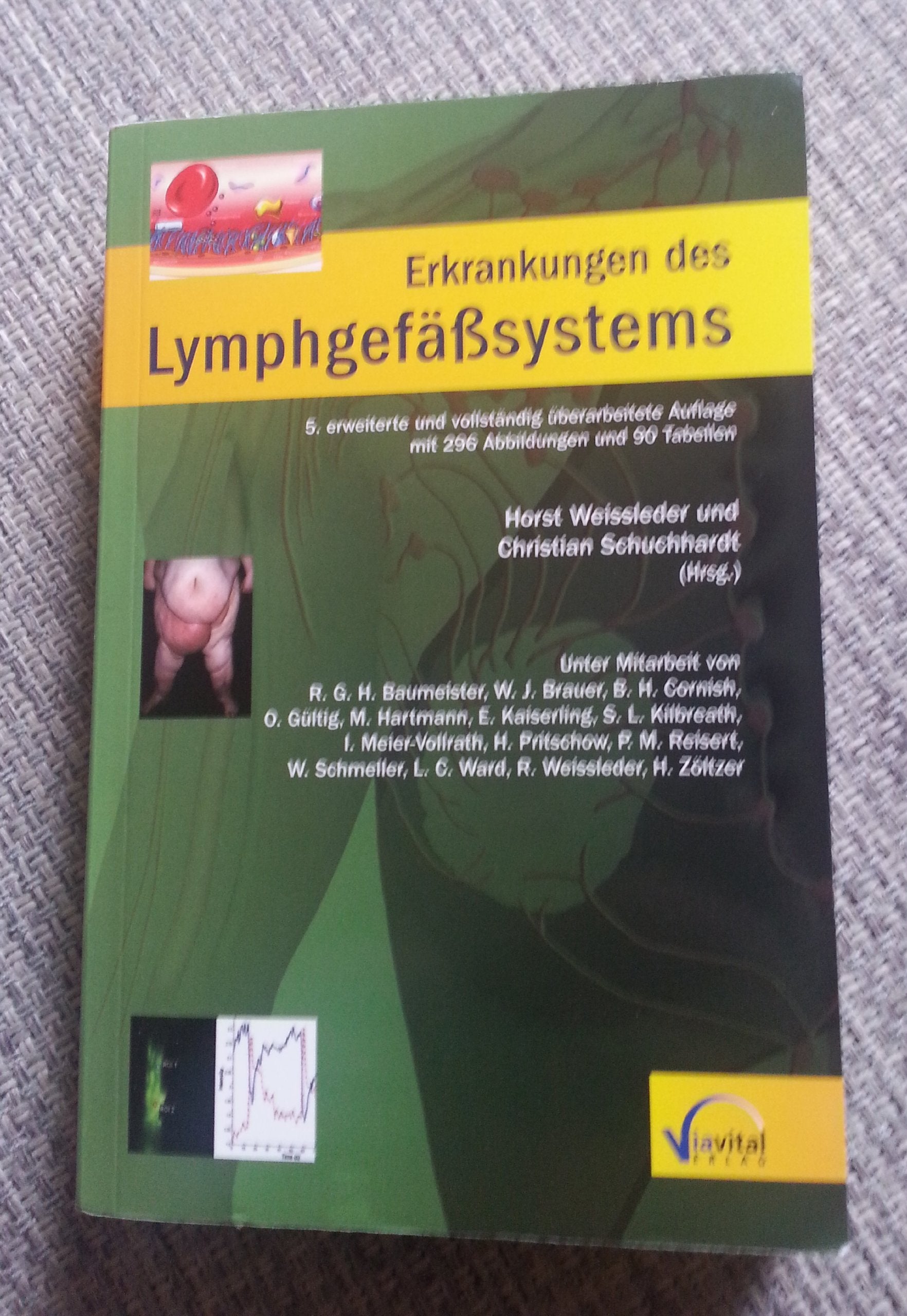 Erkrankungen des Lymphgefäßsystems Medicine
