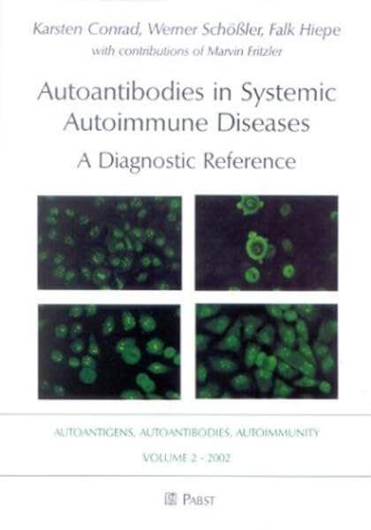 Autoantibodies in Systemic Autoimmune Diseases: A Diagnostic Reference (Autoimmunity, autoantigens, autoantibodies) Medicine