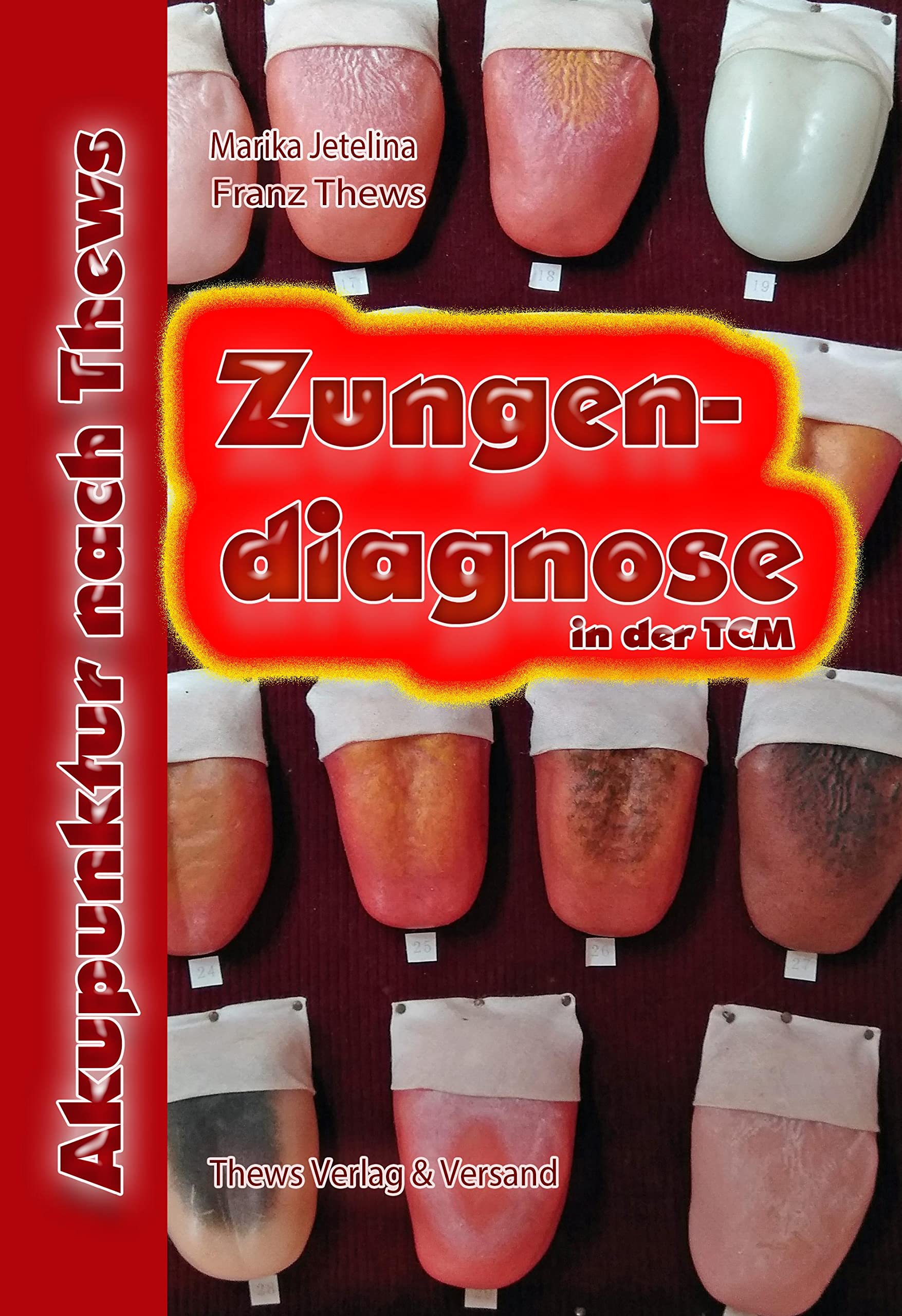 Zungendiagnose in 54 Bildern Medicine