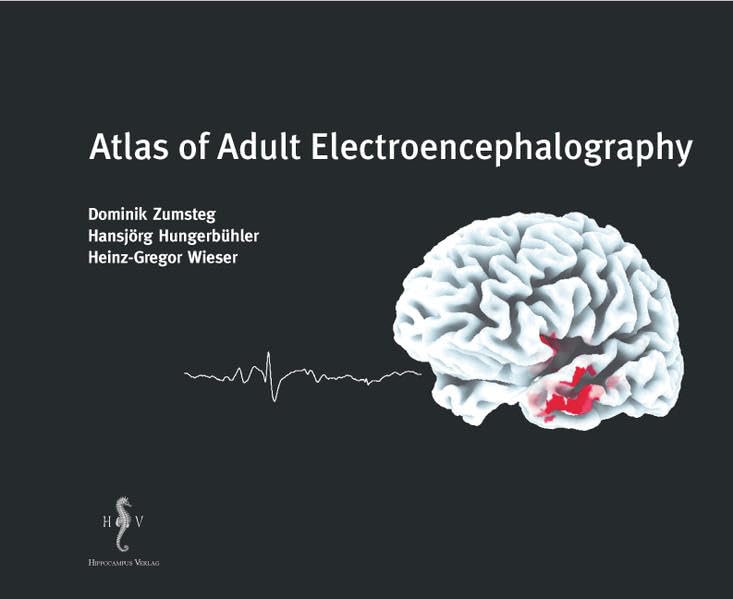 Atlas of Adult Electroencephalography Medicine