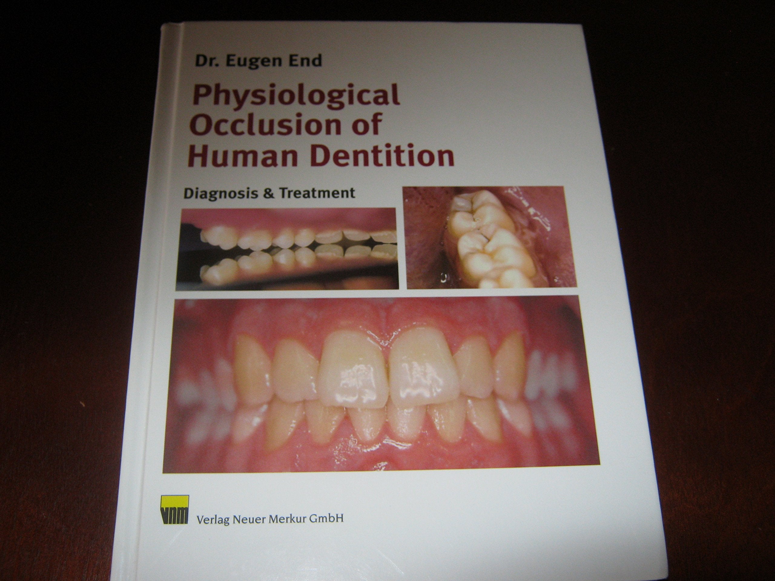 Physiological Occlusion of Human Dentism: Clinical Diagnostic and Treatment Medicine