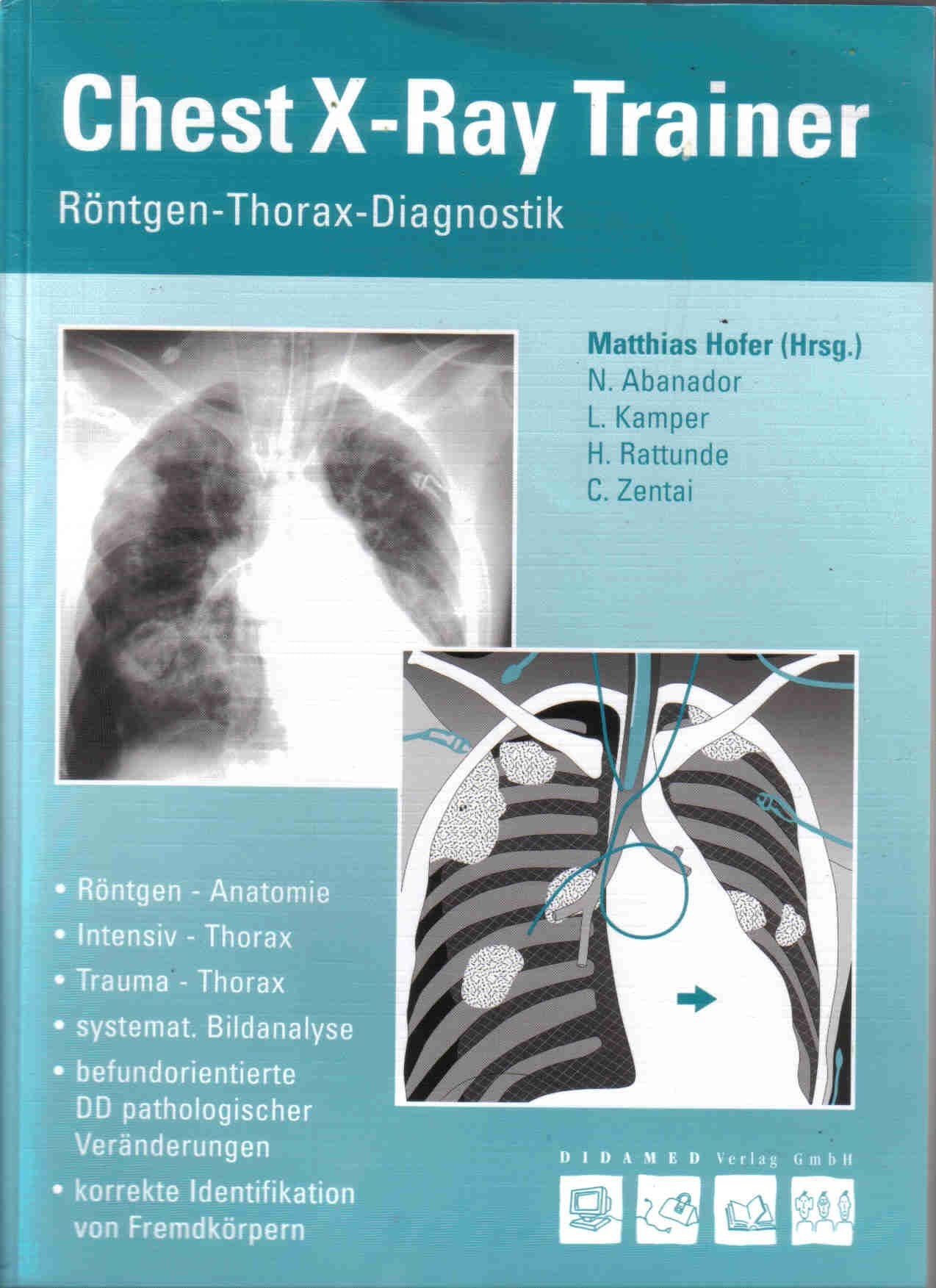 Chest X-Ray Trainer: Röntgen-Thorax-Diagnostik Medicine