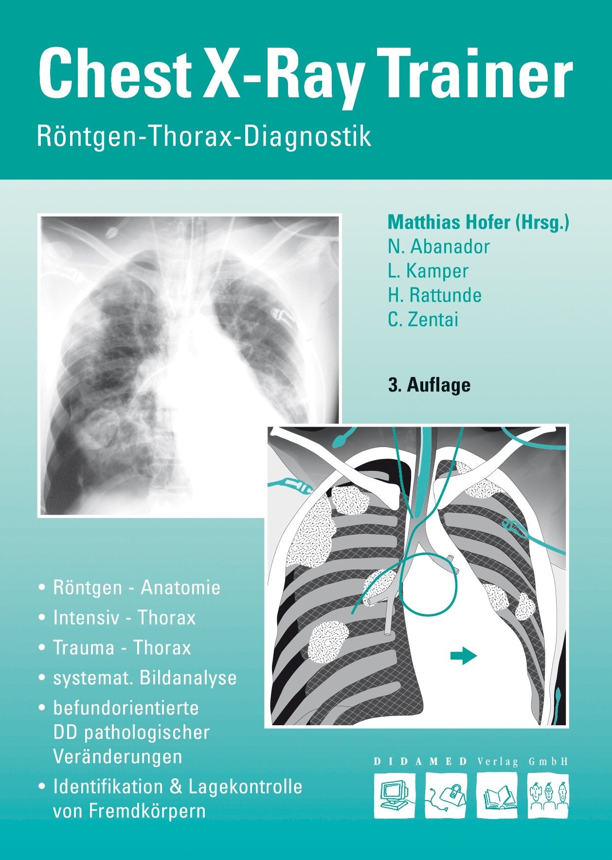 Chest-X-Ray-Trainer: Röntgen-Thorax-Diagnostik Medicine