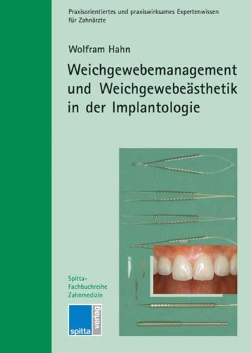 Weichgewebemanagement und Weichgewebeästhetik in der Implantologie Medicine